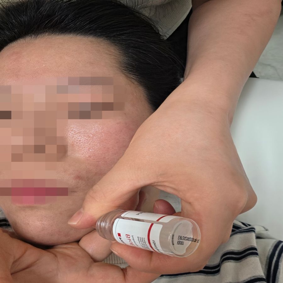 불광역 작은 — 채우리 에스테틱 앰플을 피부에 발라요
