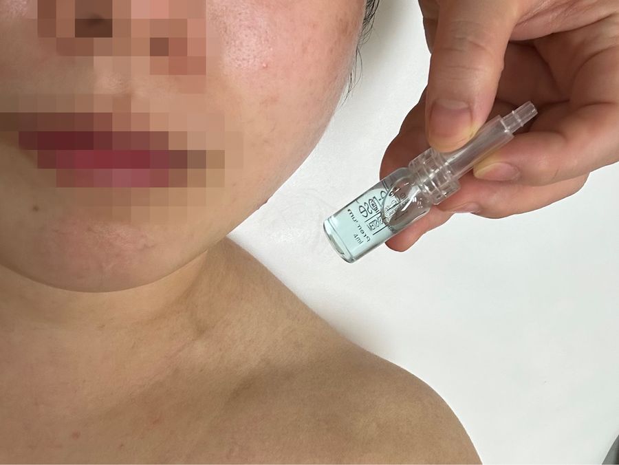 불광역 코 — 채우리 에스테틱 앰플을 피부에 발라요