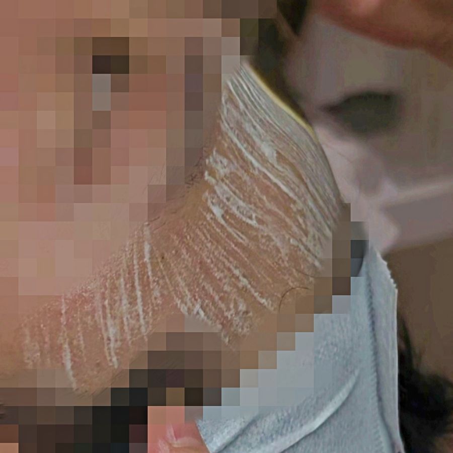 불광역 건조한 — 채우리 에스테틱 라라필504를 붓으로 고르게 발라요
