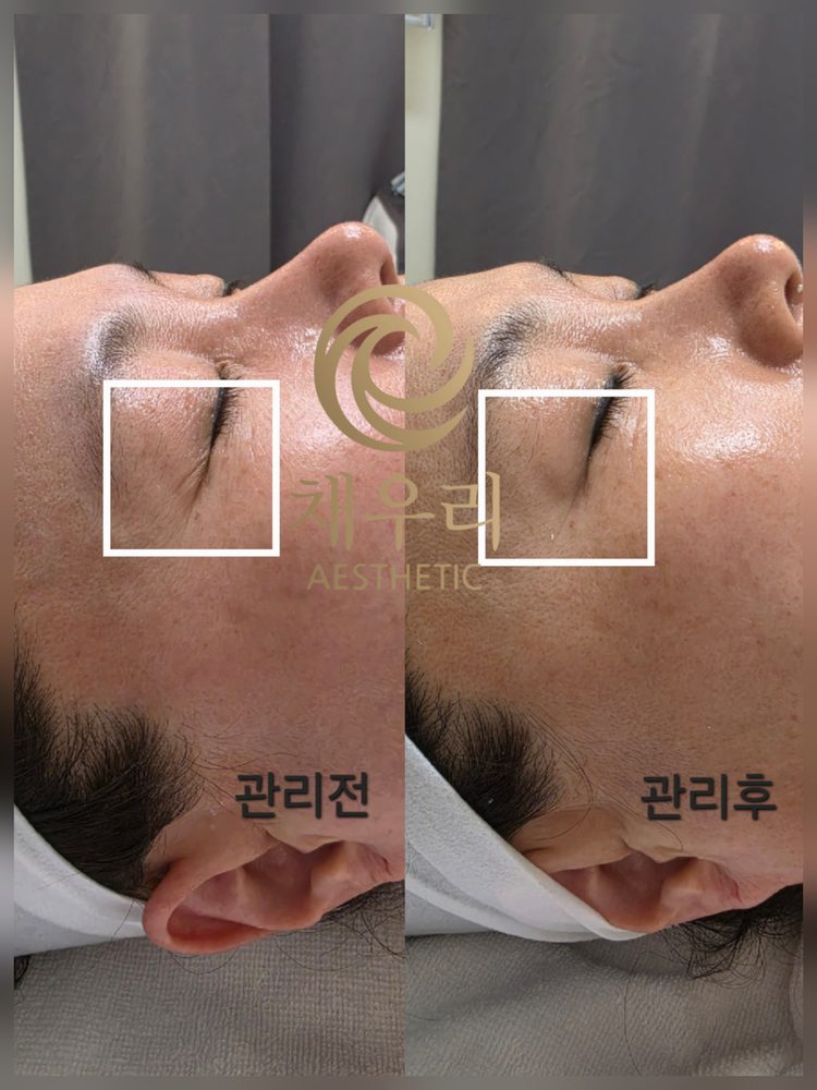 채우리 에스테틱 불광점 관리 사진 8