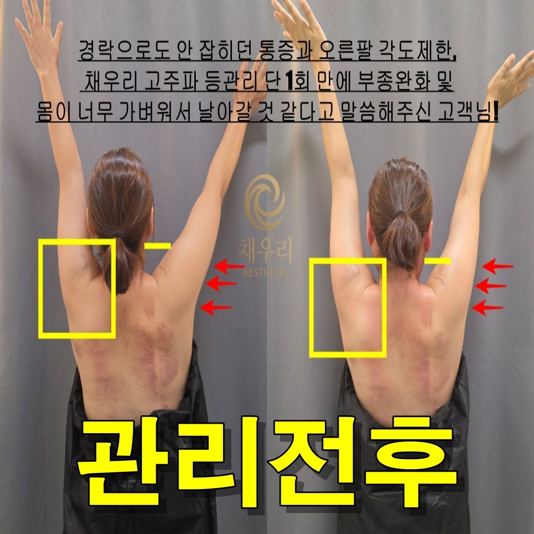 채우리 에스테틱 불광점 관리 사진 27