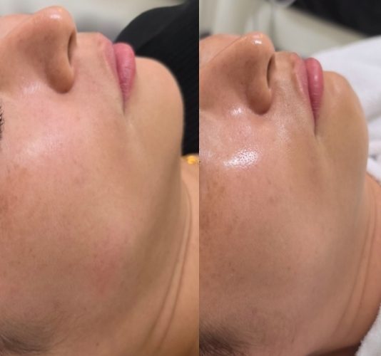 채우리 에스테틱 불광점 관리 사진 29