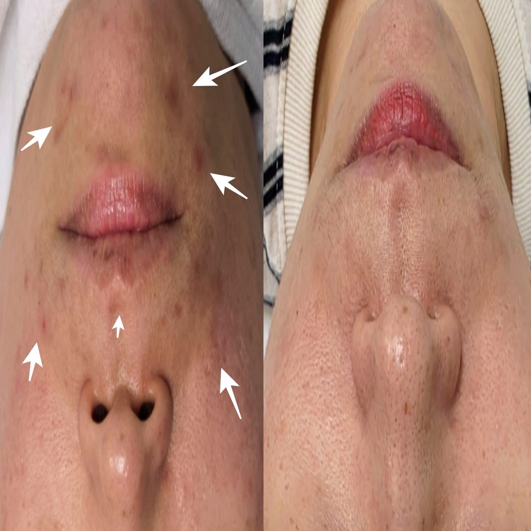 채우리 에스테틱 불광점 관리 사진 34