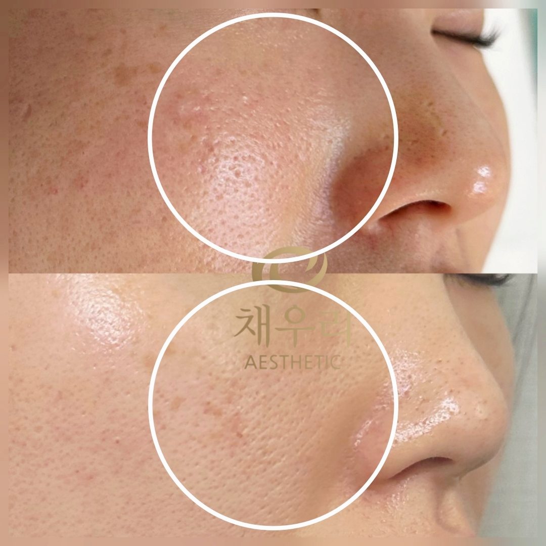 채우리 에스테틱 불광점 관리 사진 38