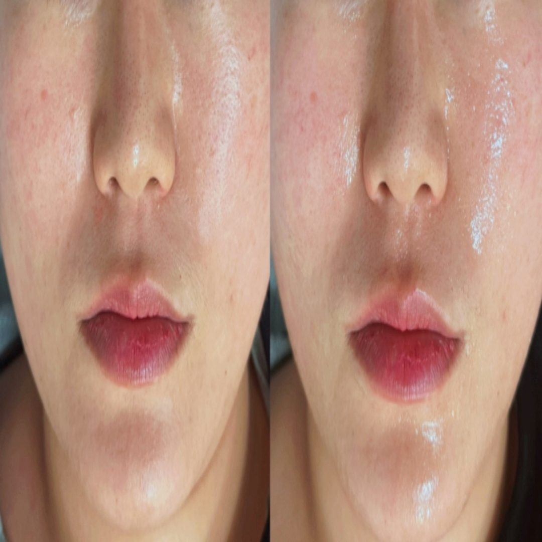 채우리 에스테틱 불광점 관리 사진 42