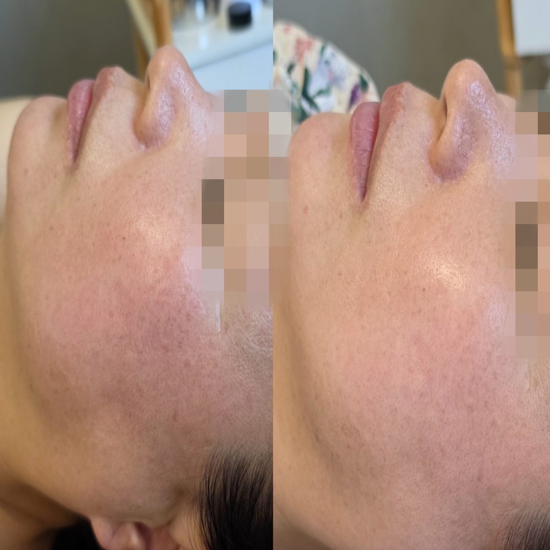 채우리 에스테틱 불광점 관리 사진 50