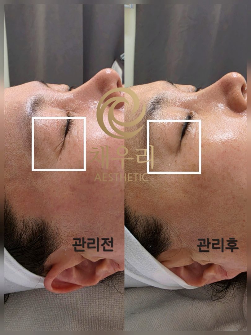 채우리 에스테틱 불광점 관리 사진 51