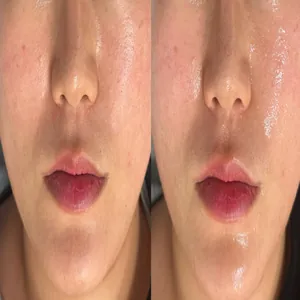 채우리 관리 사진 07