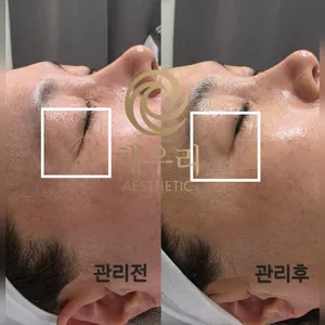 채우리 관리 사진 08