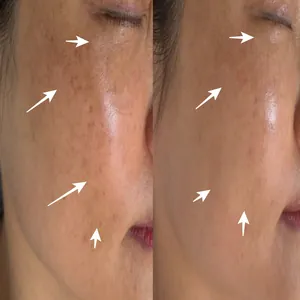 채우리 관리 사진 12